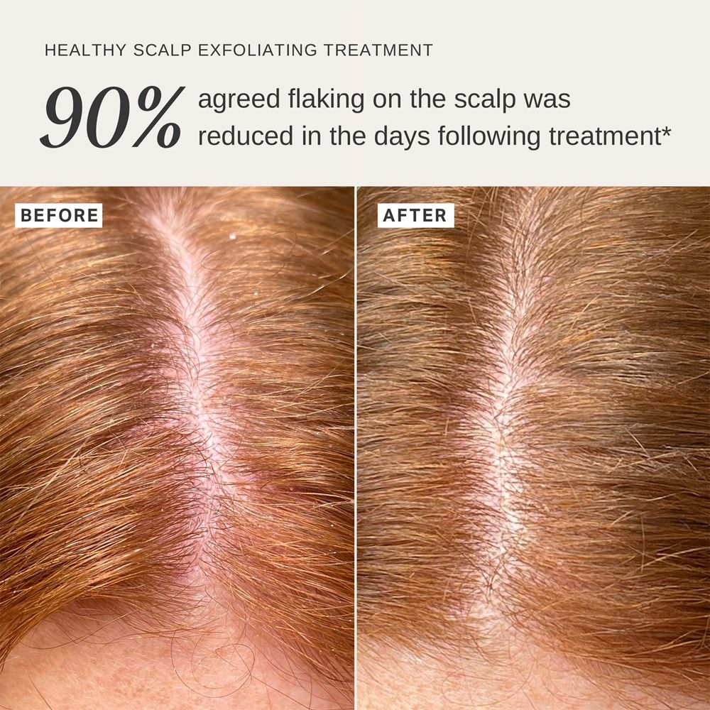 Alpha-H Healthy Scalp — foto 2