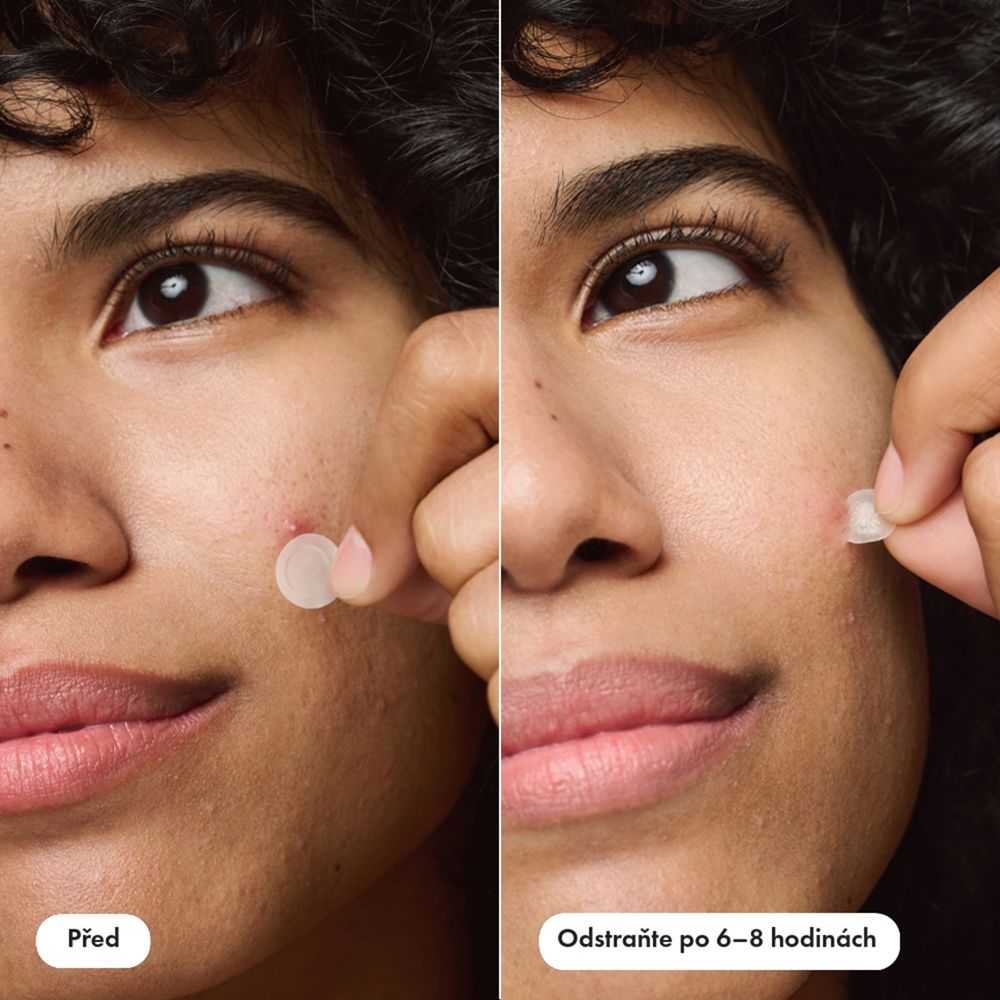 source